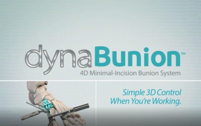 CrossRoads® Extremity Systems, LLC Announces Launch Of The DynaBunion™ 4D Minimal-Incision Lapidus System For Bunion Corrections